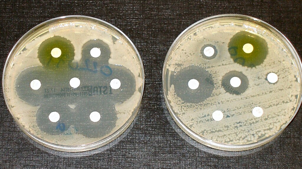 Resistência antimicrobiana: o desafio silencioso da medicina