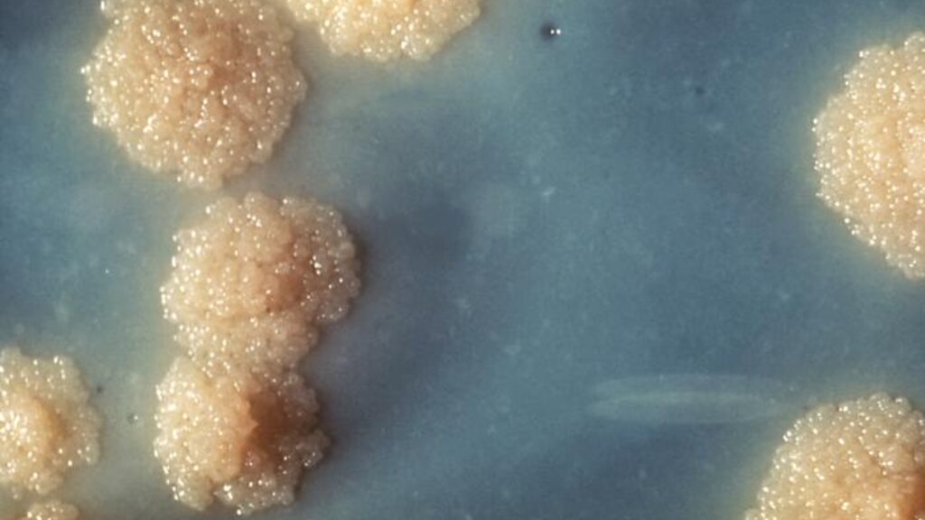Tuberculose: por que o diagnóstico precoce ainda salva vidas